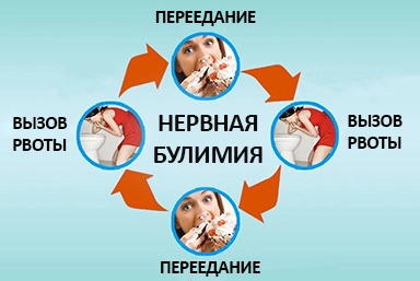 Лечение булимии в Соликамске
